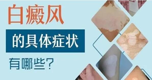 白癜风的症状是什么.jpg